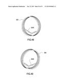 TENSIONER diagram and image