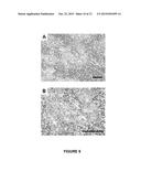 B7-H3 AS A BIOMARKER FOR DIAGNOSING THE PROGRESSION AND EARLY LYMPH NODE     METASTASIS OF CANCER diagram and image