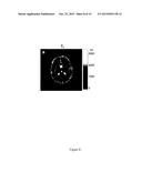 Magnetic Resonance Fingerprinting With Steady State Precession (MRF-FISP) diagram and image