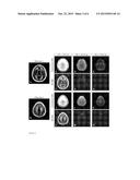 BACKGROUND-SUPPRESSED MYELIN WATER IMAGING diagram and image