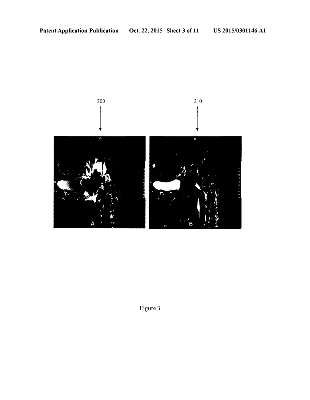 Magnetic Resonance Imaging (MRI) With Auto-Detection and Adaptive     Encodings For Offset Frequency Scanning - diagram, schematic, and image 04