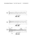 VIDEO-BASED PULSE MEASUREMENT diagram and image