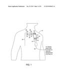 APPARATUSES AND METHODS FOR REGISTERING A REAL-TIME IMAGE FEED FROM AN     IMAGING DEVICE TO A STEERABLE CATHETER diagram and image