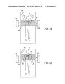 APPARATUSES AND METHODS FOR REGISTERING A REAL-TIME IMAGE FEED FROM AN     IMAGING DEVICE TO A STEERABLE CATHETER diagram and image