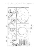 APPARATUSES AND METHODS FOR REGISTERING A REAL-TIME IMAGE FEED FROM AN     IMAGING DEVICE TO A STEERABLE CATHETER diagram and image