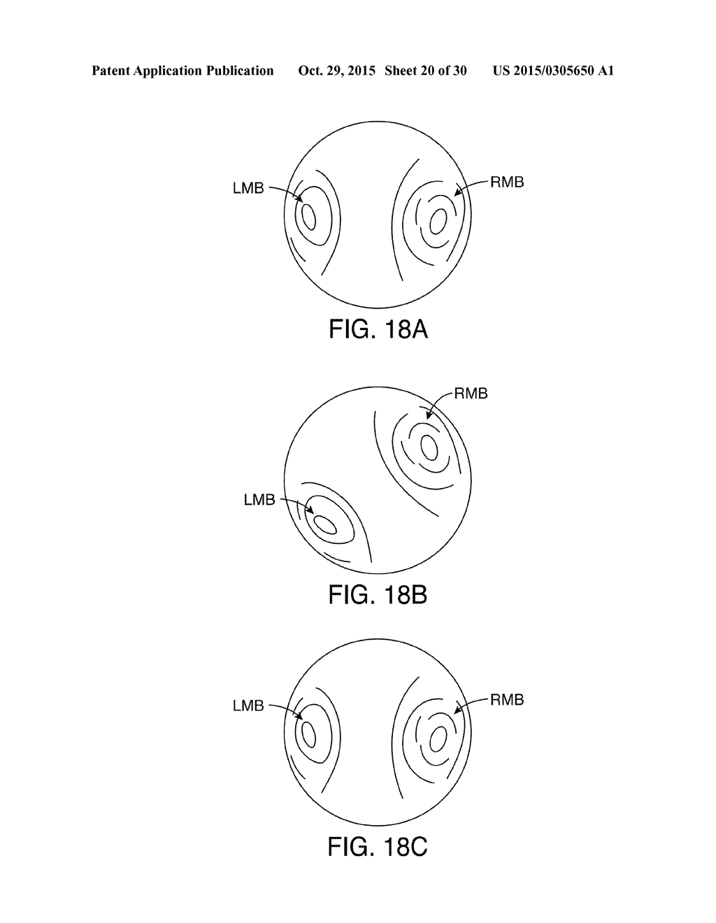 APPARATUSES AND METHODS FOR ENDOBRONCHIAL NAVIGATION TO AND CONFIRMATION     OF THE LOCATION OF A TARGET TISSUE AND PERCUTANEOUS INTERCEPTION OF THE     TARGET TISSUE - diagram, schematic, and image 21