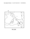 APPARATUSES AND METHODS FOR ENDOBRONCHIAL NAVIGATION TO AND CONFIRMATION     OF THE LOCATION OF A TARGET TISSUE AND PERCUTANEOUS INTERCEPTION OF THE     TARGET TISSUE diagram and image