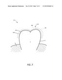 SYSTEM FOR MEASURING TEETH MOVEMENT AND CONTACT PRESSURE diagram and image