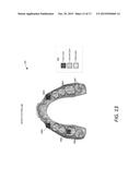 SYSTEM FOR MEASURING TEETH MOVEMENT AND CONTACT PRESSURE diagram and image