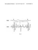 System and method for indicating coronary artery disease risk based on low     and high frequency bands diagram and image