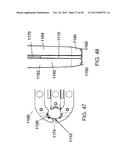 RETRACTING TISSUE diagram and image