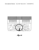 MICROSTRUCTURE-BASED WOUND CLOSURE DEVICES diagram and image