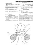 DEVICES AND METHODS FOR SECURING TISSUE diagram and image