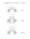 DEVICES AND METHODS FOR SECURING TISSUE diagram and image