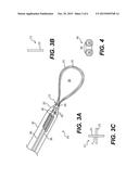 TISSUE EXTRACTION DEVICES AND RELATED METHODS diagram and image