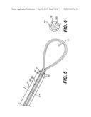 TISSUE EXTRACTION DEVICES AND RELATED METHODS diagram and image