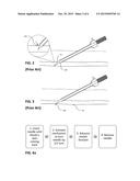 INTRODUCER CATHETER WITH A ROTATING NEEDLE TO OBTAIN VASCULAR ACCESS diagram and image