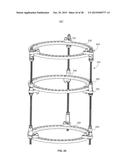 BONE TRANSPORT EXTERNAL FIXATION FRAME diagram and image