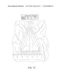 HOLLOW BODY CAVITY ABLATION APPARATUS diagram and image