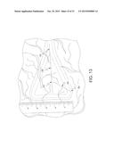 HOLLOW BODY CAVITY ABLATION APPARATUS diagram and image