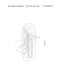 IMAGE-GUIDED THERAPEUTIC APPARATUS AND METHOD OF PREPARATION OF AN     IMAGE-GUIDED THERAPEUTIC APPRATUS FOR TREATMENT OF TISSUE diagram and image