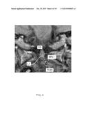 IMAGE GUIDED ATLAS CORRECTION diagram and image