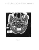 IMAGE GUIDED ATLAS CORRECTION diagram and image