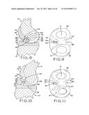 ANTERIOR CRUCIATE LIGAMENT SUBSTITUTING KNEE IMPLANTS diagram and image