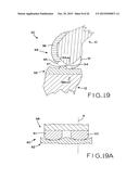 ANTERIOR CRUCIATE LIGAMENT SUBSTITUTING KNEE IMPLANTS diagram and image