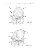 ANTERIOR CRUCIATE LIGAMENT SUBSTITUTING KNEE IMPLANTS diagram and image