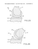 ANTERIOR CRUCIATE LIGAMENT SUBSTITUTING KNEE IMPLANTS diagram and image