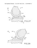 ANTERIOR CRUCIATE LIGAMENT SUBSTITUTING KNEE IMPLANTS diagram and image