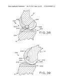 ANTERIOR CRUCIATE LIGAMENT SUBSTITUTING KNEE IMPLANTS diagram and image