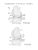 ANTERIOR CRUCIATE LIGAMENT SUBSTITUTING KNEE IMPLANTS diagram and image