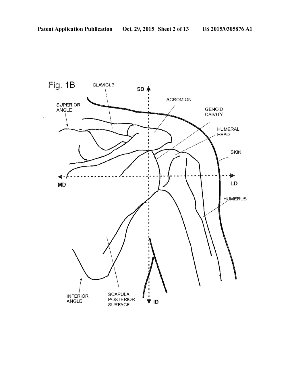 IMPLANTABLE GLENOID PROSTHESES - diagram, schematic, and image 03