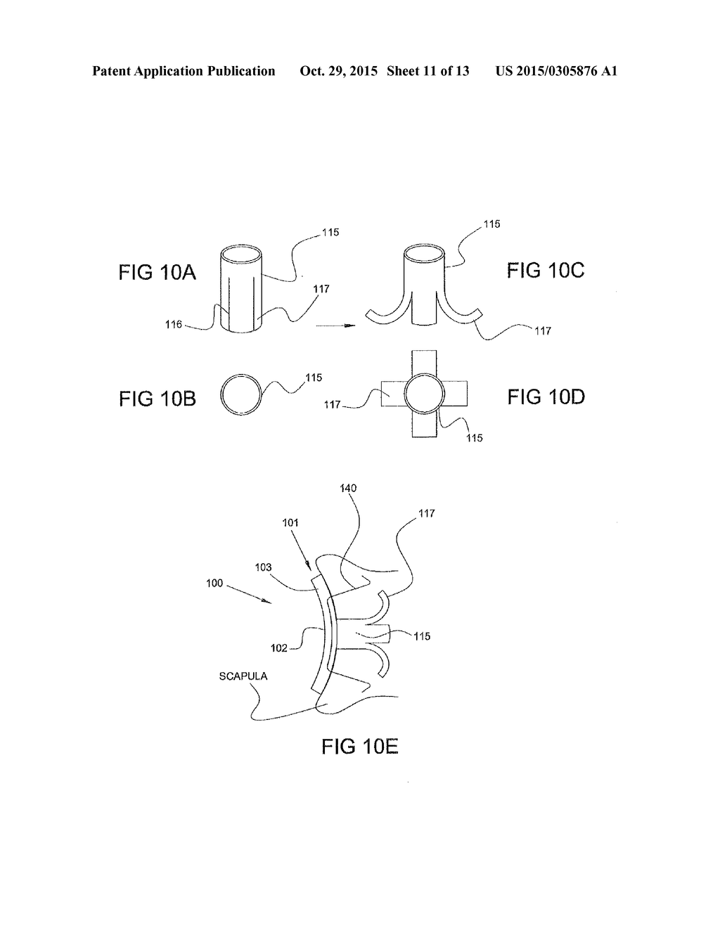 IMPLANTABLE GLENOID PROSTHESES - diagram, schematic, and image 12