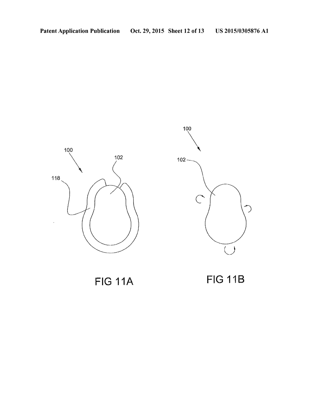 IMPLANTABLE GLENOID PROSTHESES - diagram, schematic, and image 13