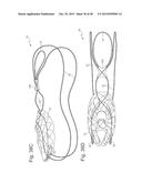 Bariatric Device and Method for Weight Loss diagram and image