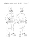 Bariatric Device and Method for Weight Loss diagram and image