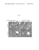 PREVENTION OR TREATMENT AGENT FOR HEPATIC FIBROSIS diagram and image