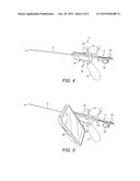 TREATMENT OF HEADACHE BY INJECTION OF NEUROINHIBITORY SUBSTANCE TO     SPHENOPALATINE GANGLION OR OTIC GANGLION diagram and image