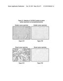 ANTIBODY DRUG CONJUGATES (ADC) THAT BIND TO 191P4D12 PROTEINS diagram and image