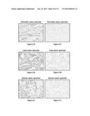 ANTIBODY DRUG CONJUGATES (ADC) THAT BIND TO 191P4D12 PROTEINS diagram and image