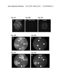 COMPOSITIONS AND METHODS FOR DETECTING COMPLEMENT ACTIVATION diagram and image