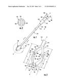 SPLIT-TIP CATHETER diagram and image