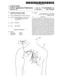 METHOD AND APPARATUS FOR DETECTING LOSS OF CAPTURE diagram and image