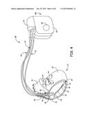 METHOD AND APPARATUS FOR DETECTING LOSS OF CAPTURE diagram and image