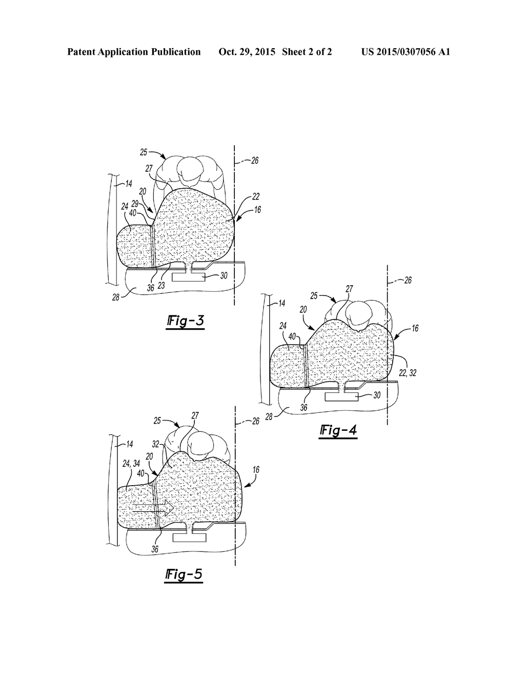 PASSENGER AIRBAG WITH EXTENDED BASE - diagram, schematic, and image 03