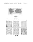 Compositions and Methods for the Treatment of Metabolic and Related     Disorders diagram and image