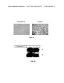 Compositions and Methods for the Treatment of Metabolic and Related     Disorders diagram and image